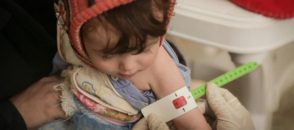Bei einem Gesundheits-Check wird der Armumfang eines Kindes im Jemen gemessen.