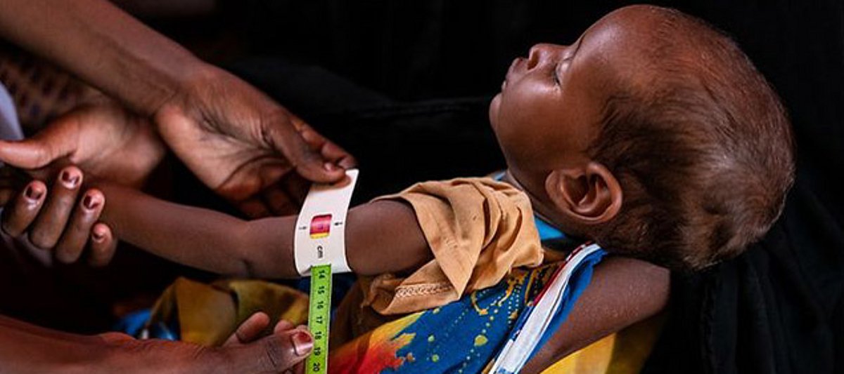 Ein Kind in Somalia wird durch Messung des Oberarmumfangs auf Unterernährung untersucht. 